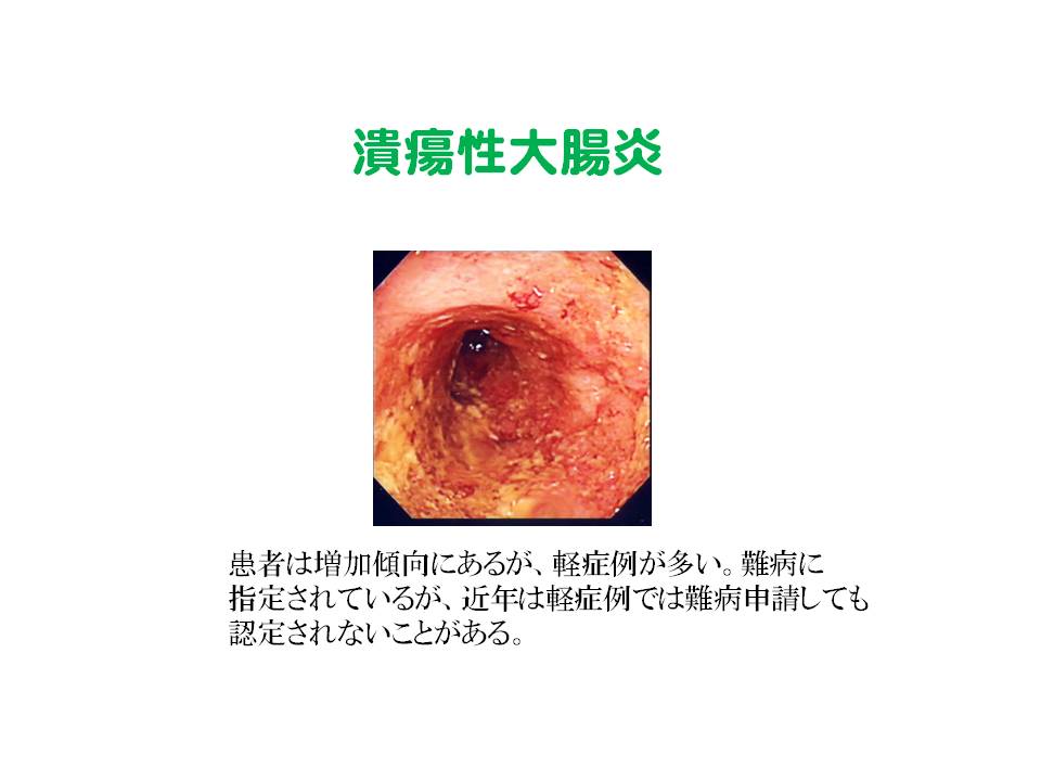 7）潰瘍性大腸炎